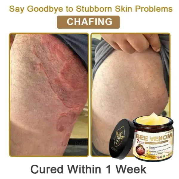 Bee Venom Skin Comprehensive Cream - Image 8