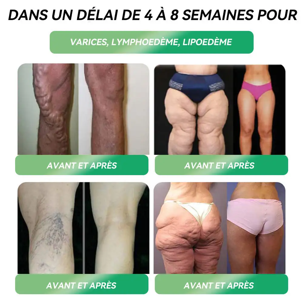Solution Orale Minceur - Image 6
