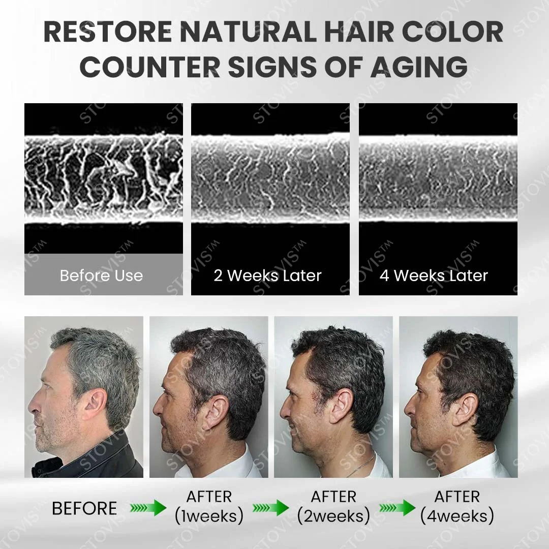 Beard & Hair Darkening Essence Spray - Image 6