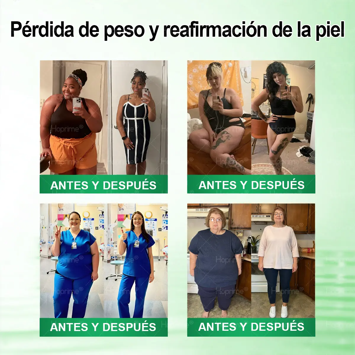 𝑴𝒐𝒓𝒊𝒏𝒈𝗮 · 𝗕𝗲𝗿𝗯𝗲𝗿𝙞𝙣𝙚 × 𝙉𝐀𝐃+ 10-en-1 Parche Avanzado de Nano Microagujas - Image 3
