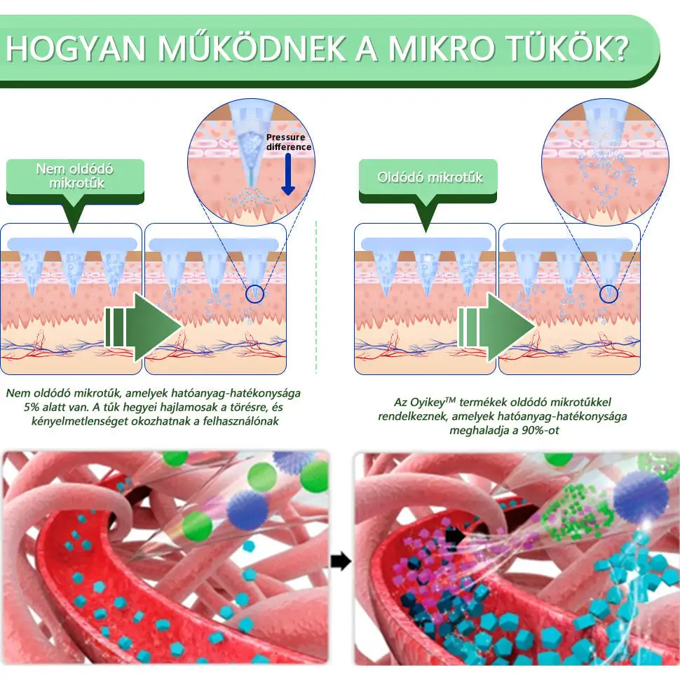 Nano Mikrotűs Tapasz - Image 3