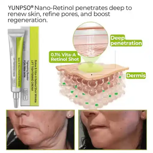 Botox Vita-A Retinol Shot Wrinkle-Lift Tightening cream