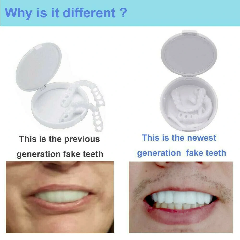 New Plus Protection Snap-On Dentures - Image 6