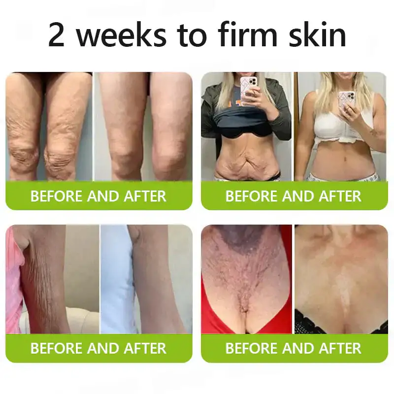 BOTOX & VITA A RETINOL SHOT Wrinkle Lift Tightening Cream - Image 12