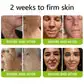 BOTOX & VITA A RETINOL SHOT Wrinkle Lift Tightening Cream - Image 30
