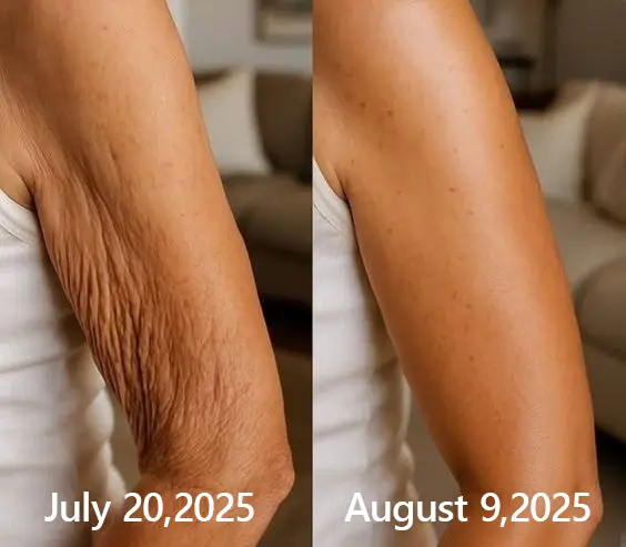 BOTOX & VITA A RETINOL SHOT Wrinkle Lift Tightening Cream - Image 51