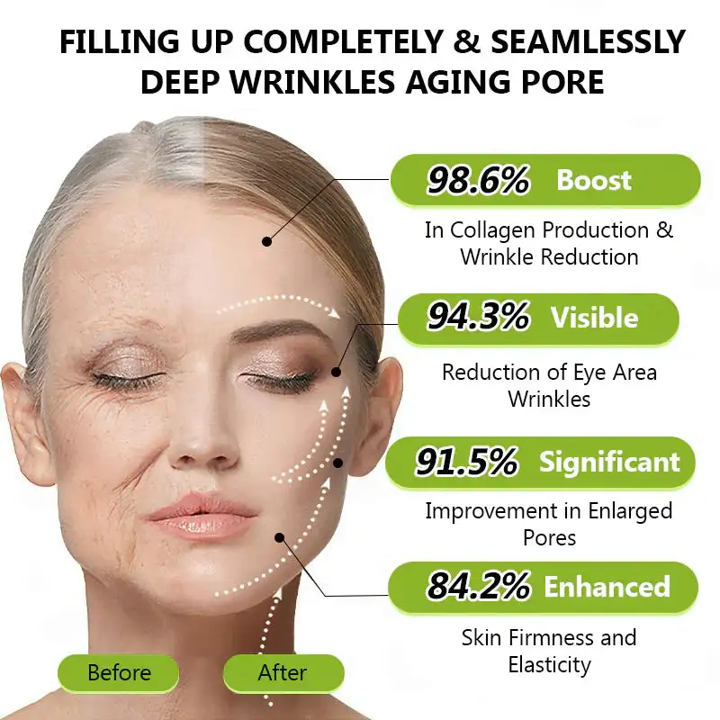 BOTOX & VITA A RETINOL SHOT Wrinkle Lift Tightening Cream - Image 7