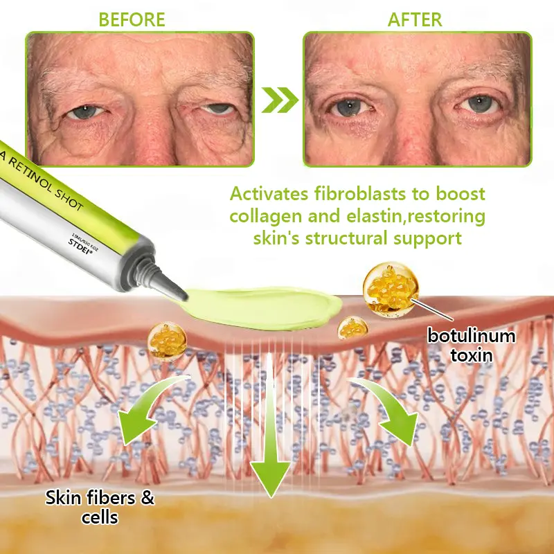 BOTOX & VITA A RETINOL SHOT Wrinkle Lift Tightening Cream - Image 61
