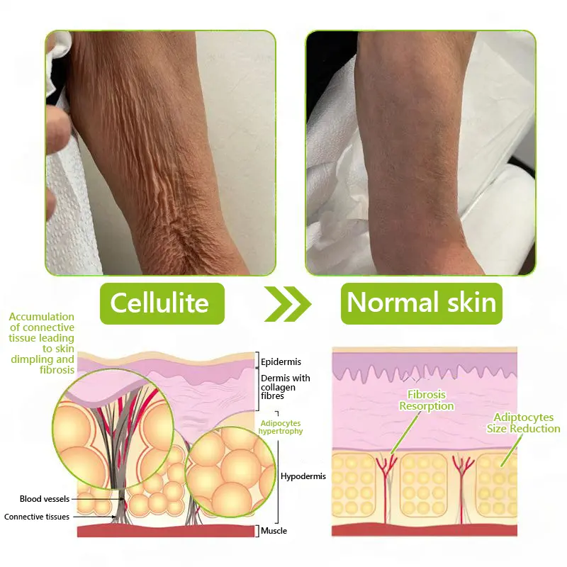 BOTOX & VITA A RETINOL SHOT Wrinkle Lift Tightening Cream - Image 63