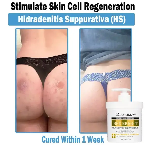 Bee Bright Multi-Symptom Skin Treatment Cream - Image 10