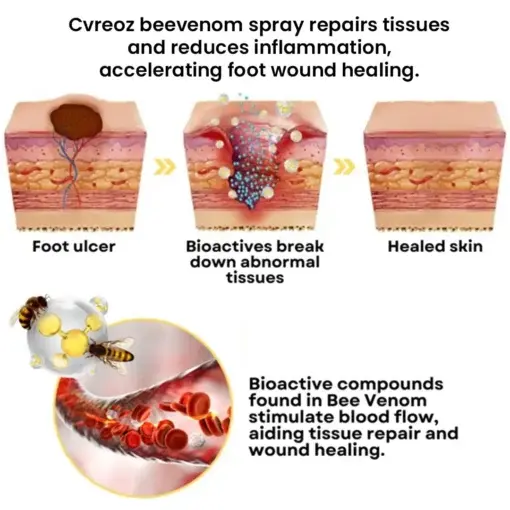 Bee Venom Diabetic Foot Healing Spray - Image 10