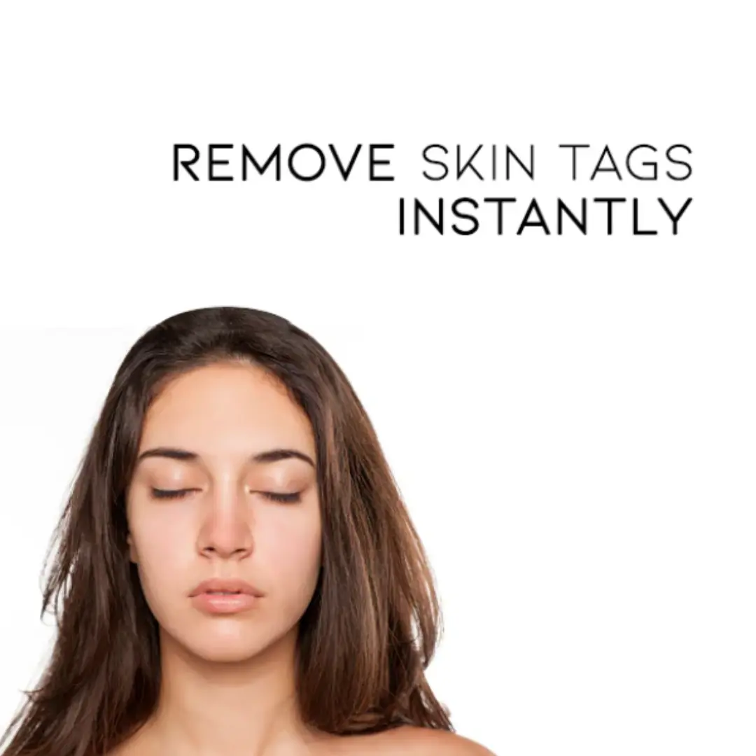 Bee Venom Mole and Wart Treatment Cream - LIMITED-TIME OFFER - Image 7