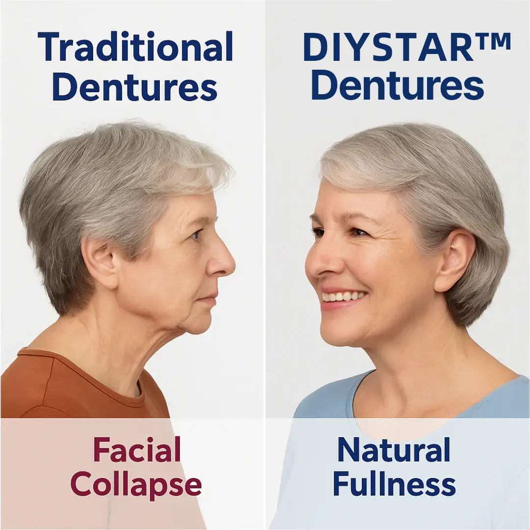 Custom-Fit Functional Dentures - Image 2