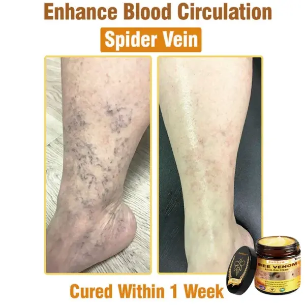 Botulinum Toxin & BEE Venom Pain-Relief Bone Healing Cream - Image 5