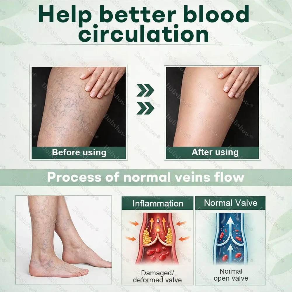 LymphDrain Herbal Soothing Cream - Image 6