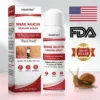 Snail Mucin Healing Spray – Relief for Sensitive & Flare-Up Skin