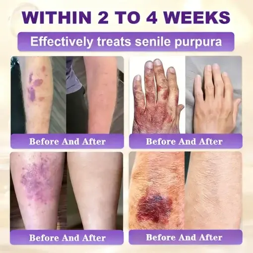 Biotin 10-in-1 Skin Restoration Cream - Image 13