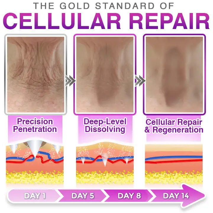 3-in-1 Microneedle Anti-Aging Patch - Image 3