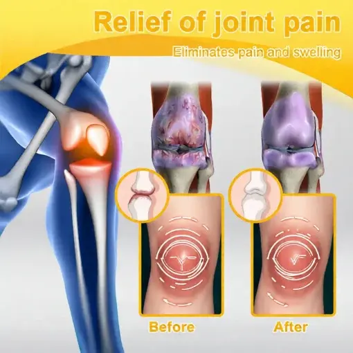 Bee Poison Pain-Relief Bone Healing Cream - Image 12