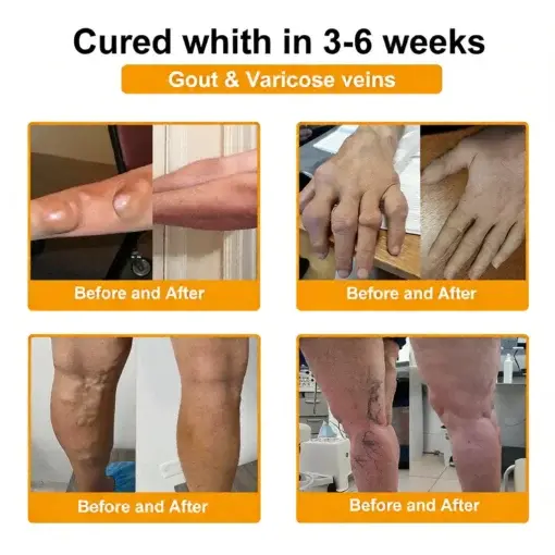 Bee Poison Pain-Relief Bone Healing Cream - Image 5