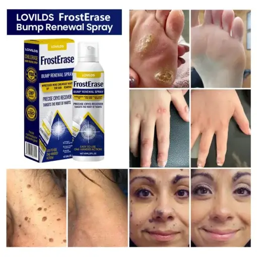 FrostErase Bump Renewal Spray - Image 2