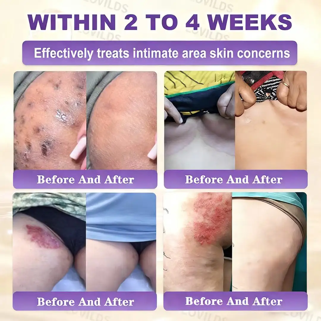 Made and Shipped from UK Biotin 10-in-1 Skin Restoration Cream - Image 3