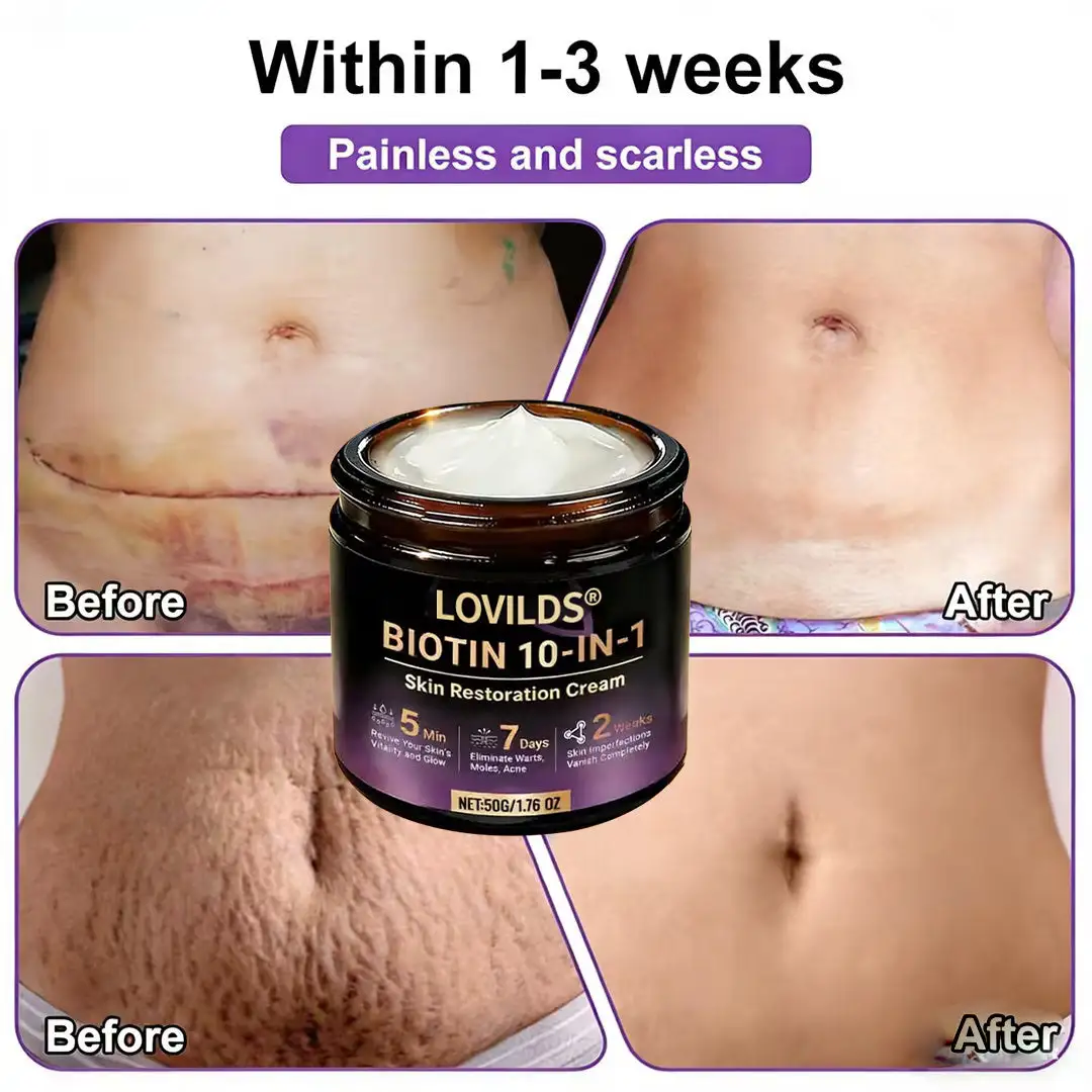 Made and Shipped from UK Biotin 10-in-1 Skin Restoration Cream🌻🌻 - Image 5