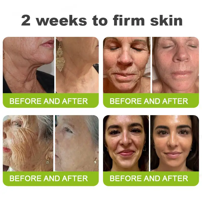 👏🌿Made and shipped from the USA Botox & Vita-A Retinol Shot Wrinkle-Lift Tightening cream - Last Day Promotion 70% OFF - Image 4