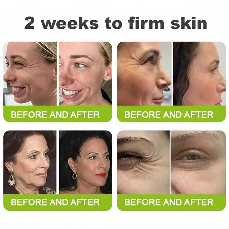 moringa & Vita-A Retinol Shot Wrinkle-Lift Tightening cream - Last Day Promotion 70% OFF - Image 6
