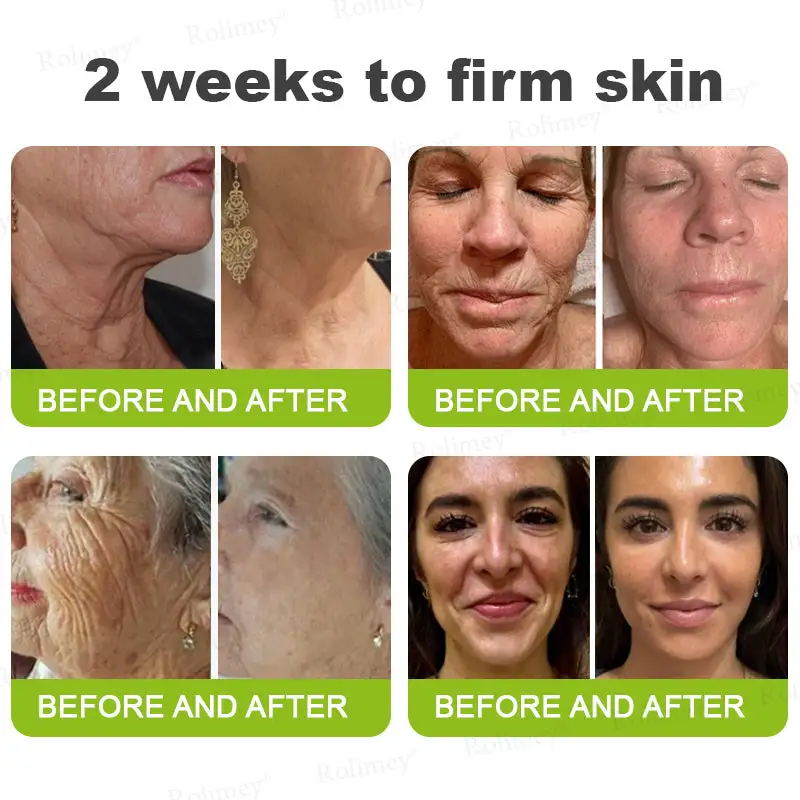 Made and shipped from the USA 🎉 Botox & Vita-A Retinol Shot Wrinkle-Lift Tightening Cream - Image 7
