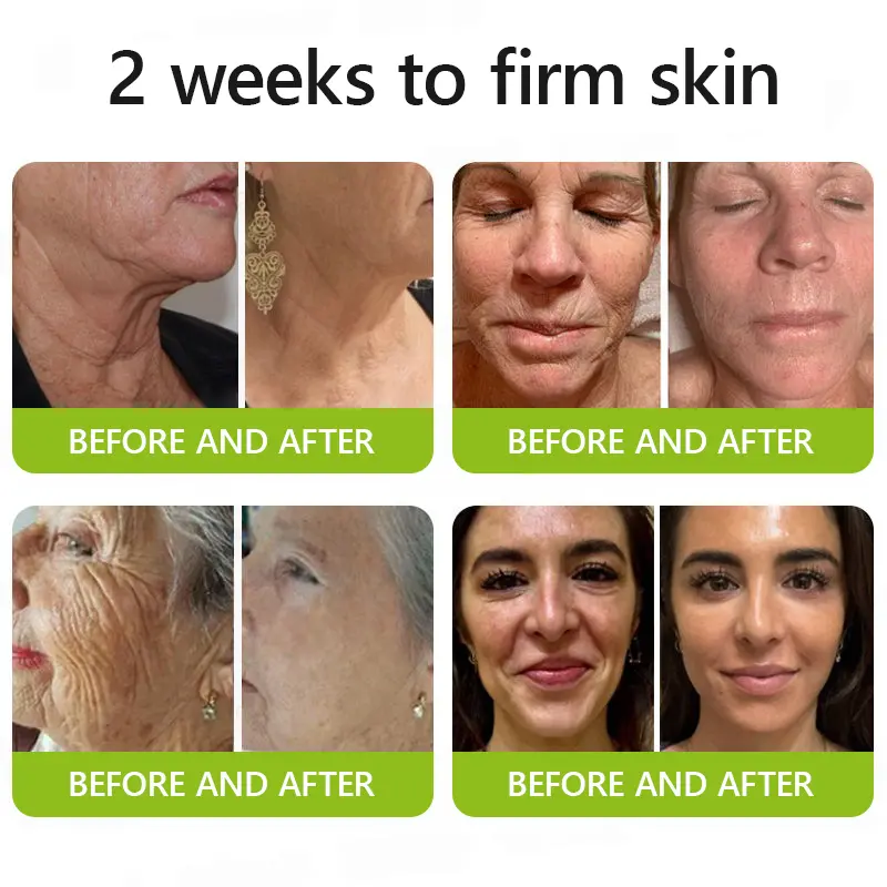 Botox & Retinol Shot - Image 3