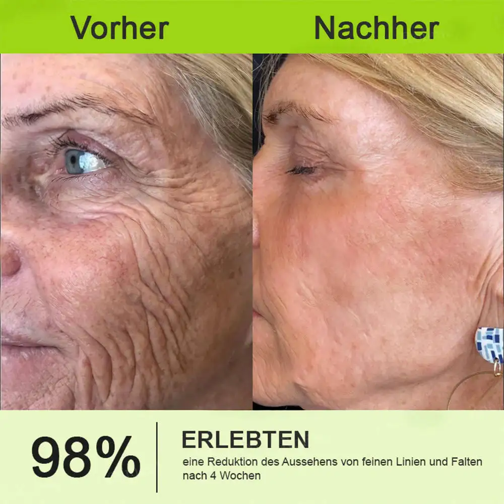Now regain youthful skin. 💫👨⚕️ NESLEMY ™ Wrinkle relaxer & Vita-A Retinol Shot Wrinkle Lift Firming Cream - Image 12