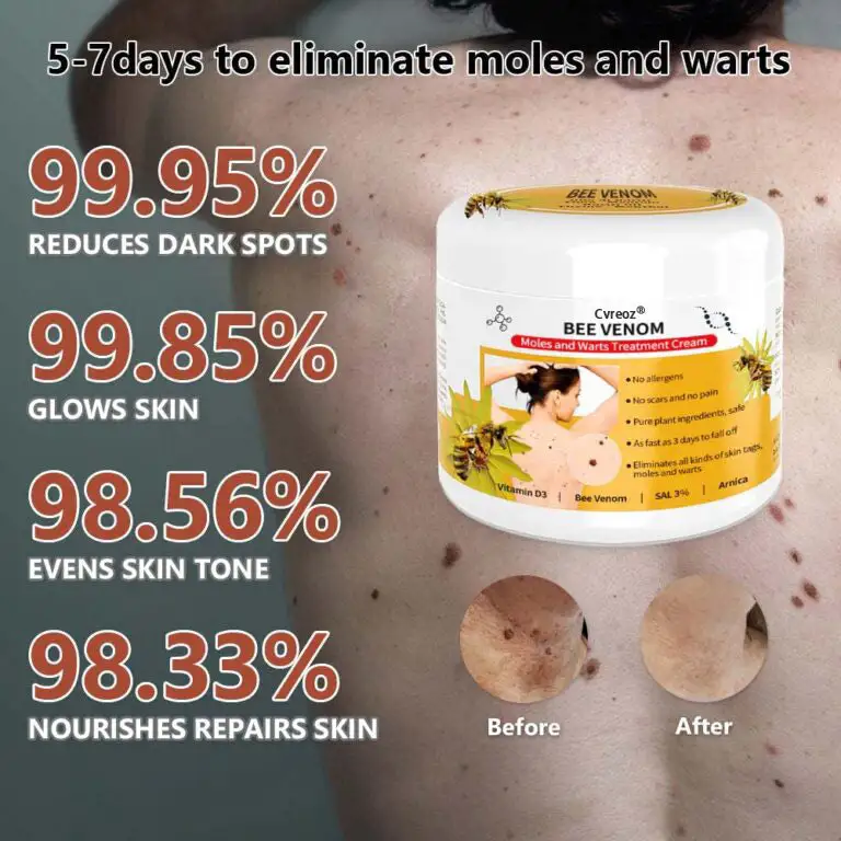 PRO Bee Venom Mole and Wart Treatment Cream - Image 3