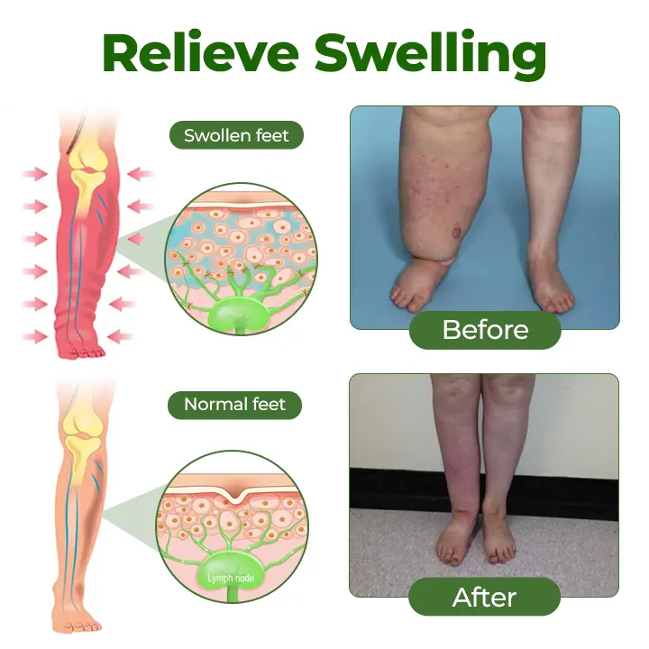 Advanced Leg Circulation Cream - Image 6