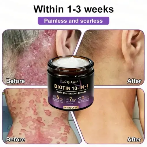 Proprietary Biotin Blend Skin Restoration Cream - Image 5