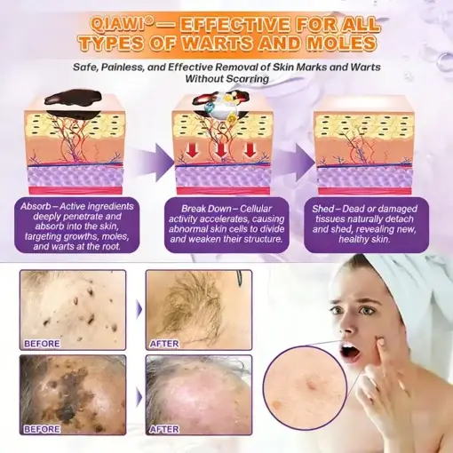 Proprietary Biotin Blend Skin Restoration Cream - Image 9
