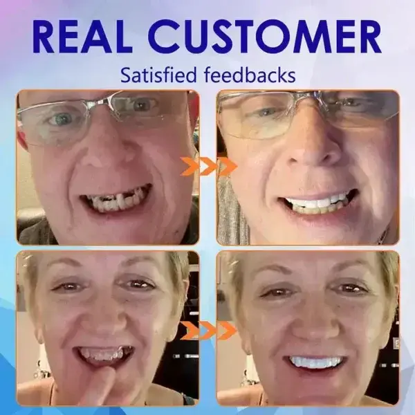 Ease Dentures - Image 4