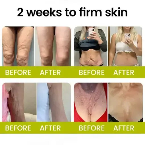 Botox Retinol Shot Smoother-Looking Skin for Deep Lines, Sagging Jowls Puffy Eyes - Image 4