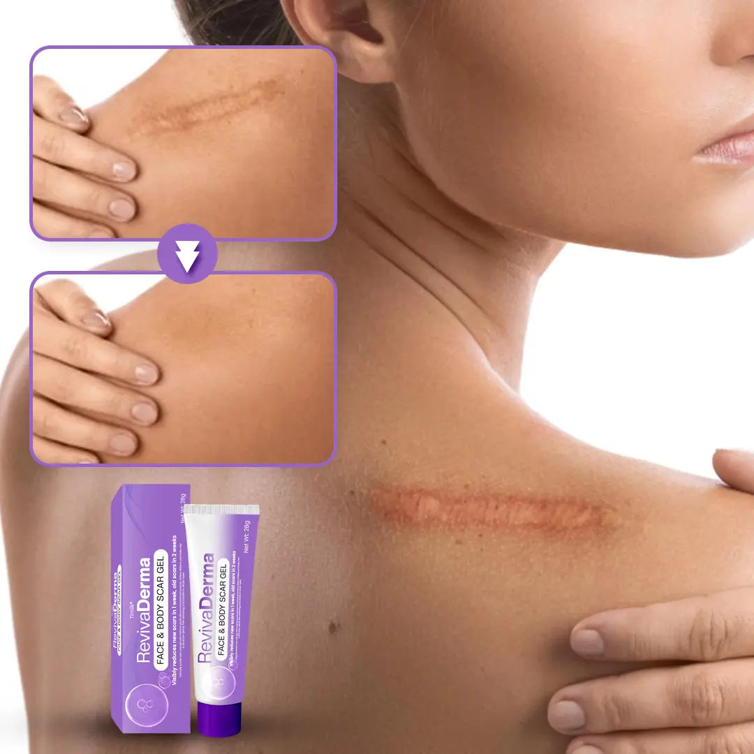 RevivaDerma Face & Body Scar Gel - Image 10