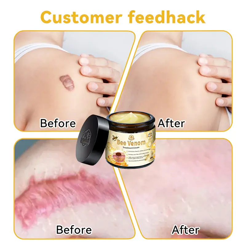 Aotearoa Bee Venom Skin Treatment Cream - Image 10