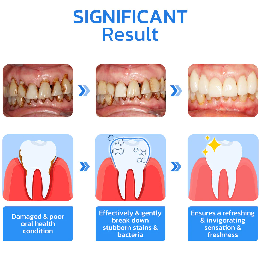 Gum Repair Strips - Image 3