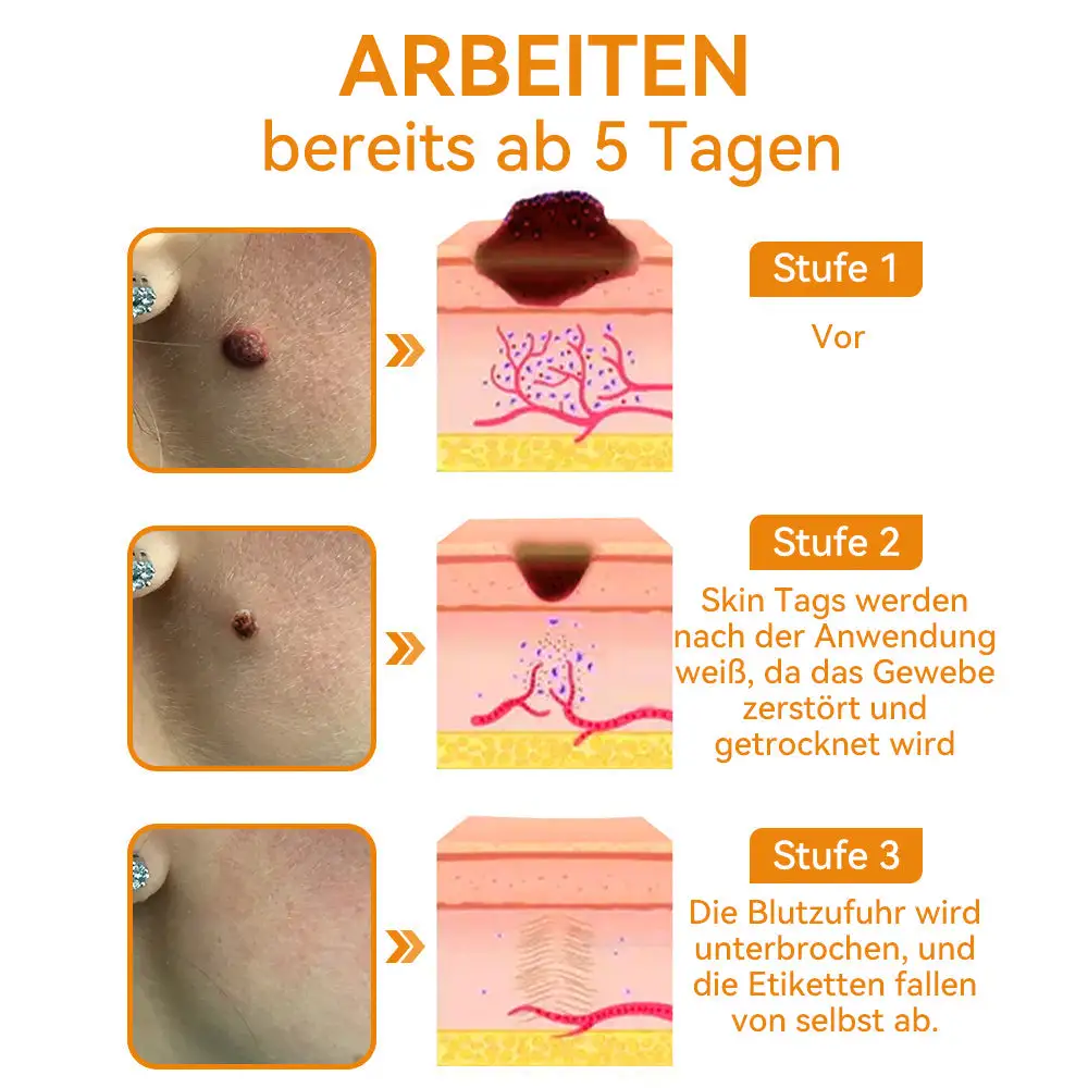 Bienengift Waren & Muttermalenfernung Creme - Image 11
