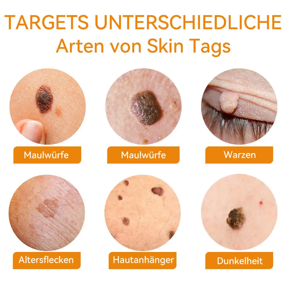 Bienengift Waren & Muttermalenfernung Creme - Image 7