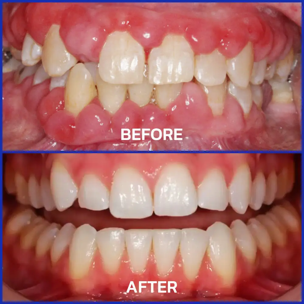 VioCore Dental Treatment Toothpaste - Image 8