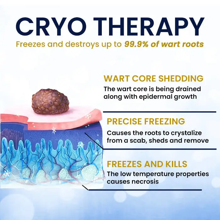 Skin Tag Cryo Treatment Spray - Image 4