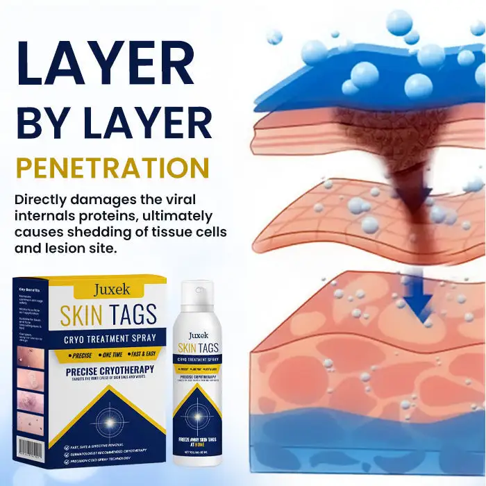 Skin Tag Cryo Treatment Spray - Image 5