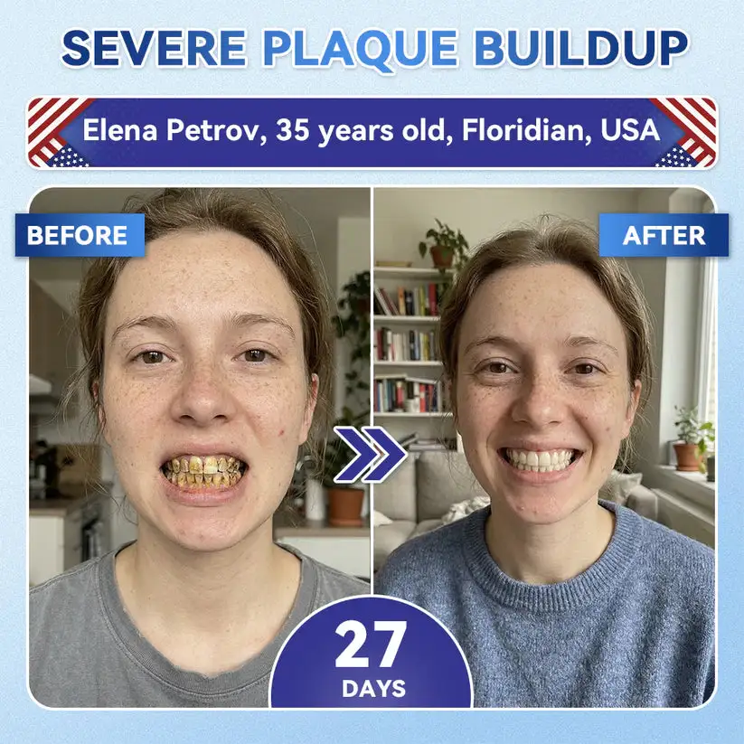 𝟓-𝒊𝒏-𝟏 𝑻𝒊𝒅𝒆𝒈𝒍𝒖𝒔𝒊𝒃 𝑻𝒐𝒐𝒕𝒉 𝑶𝒓𝒂𝒍 𝑺𝒕𝒓𝒊𝒑𝒔 & Gum Repair Oral Strips - Image 8