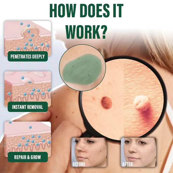 DermaErase Instant Mole & Spot Remover Gel - Image 6