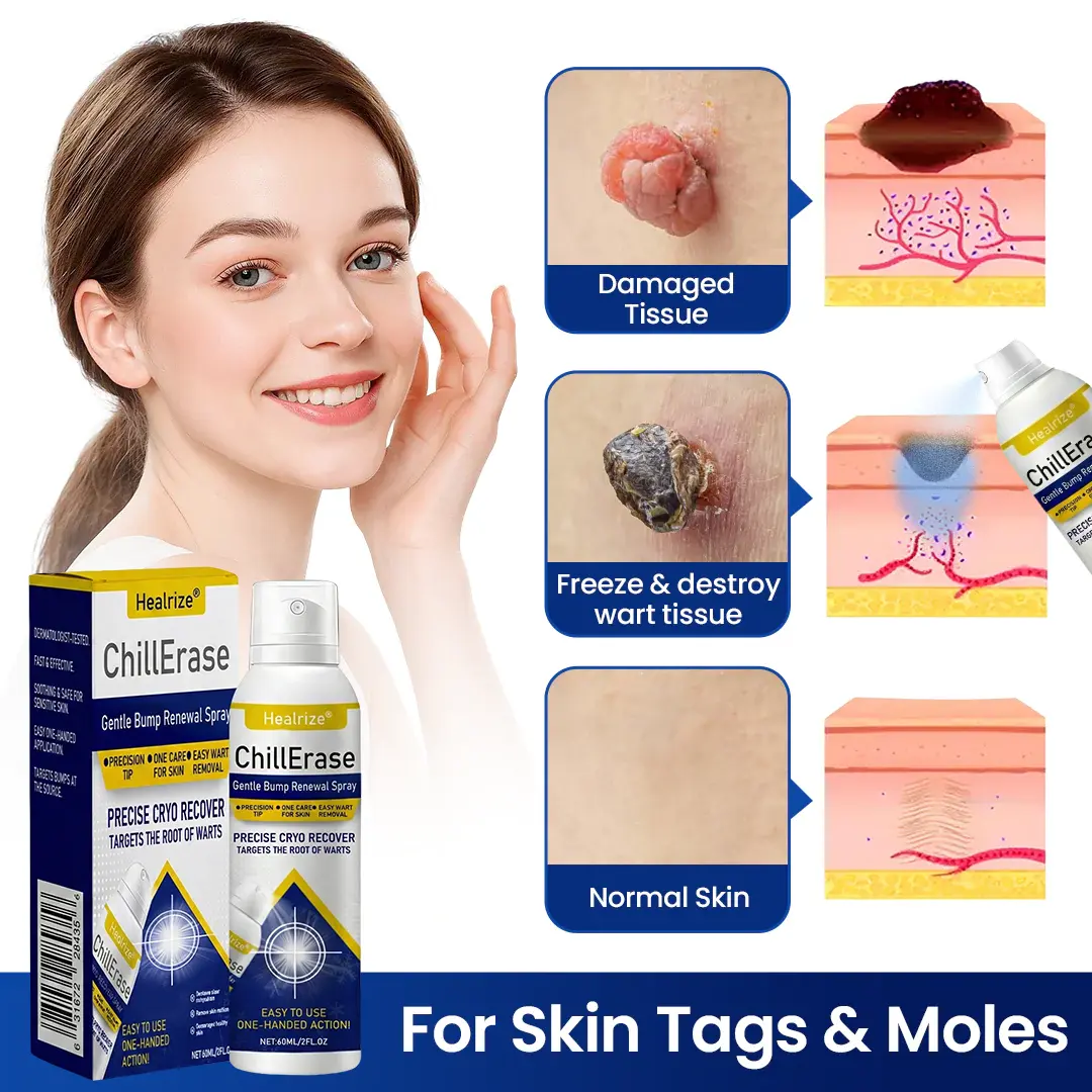 ChillErase Gentle Bump Renewal Spray—Stubborn Skin Bumps & Rough Spots - Image 2