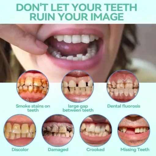 Premium Denture AdaptableFit Functional Dentures - Image 7